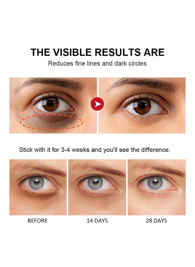 paminify عصا العين بالريتينول مع الكولاجين وحمض الهيالورونيك لدوائر الظلام والتجاعيد نتائج مرئية في 34 أسبوع كريم تحت العين المضاد للشيخوخة كريم العين بالريتينول للتورم والحقائب يقلل الخطوط الدقيقة - Image 3