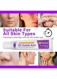 CARVENCHY Azelaic Acid Serum, Azelaic Acid 12% Cream，Hyaluronic Acid and Niacinamide, Relieves Redness, Dark Spots, Rosacea, Balances Excess Sebum, Brightening Face Skin Care Treatment for All Skin Types 20g  - Image 3