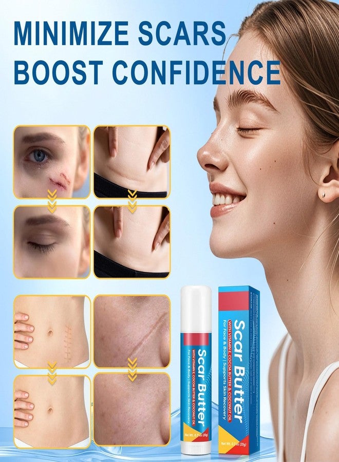 Moulis Scar Stick, with Vitamin E, Cocoa Butter & Coconut Oil, 5-in-1 Skin Nourishing Formula, Effectively Reduces Appearance of Scars & Fine Lines, Skin Recovery Support, Pack of 2 - Image 2