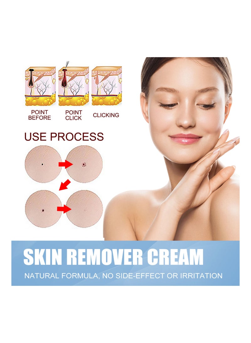 EELHOE Natural Wart Remover Cream  - Image 4