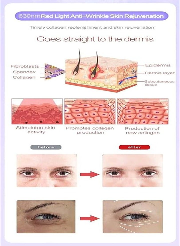 Upgraded version, micro-current eye beauty instrument, eye massager, promotes collagen production, significantly reduces wrinkles, dark circles and eye puffiness - Image 5