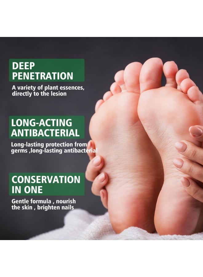 SOUTH MOON Hand Ringworm BeriBeri Fungus Spray, Anti-Fungi Treatment For Feet Itchy, Sweating, Peeling And Blisters, Natural Ingredients Foot Fungi Spray For Tinea Pedis, Inflamed, Feet Smelly 30ML - Image 5