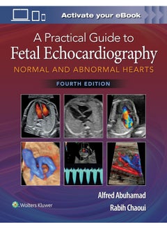 A Practical Guide to Fetal Echocardiography: Normal and Abnormal Hearts - pzsku/Z33C157EE3F3DE73D58F7Z/45/_/1739453190/4fee8c56-7a44-400a-8242-bd4e3e60b0b4