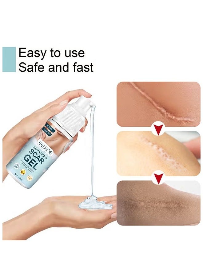 إيلهو جل الندبات المتقدم، جل طبي لإزالة الندبات، جل متقدم لإزالة الندبات الجراحية، علامات التمدد، حب الشباب، الإصابات، الحروق، الجدرة، الندبات القديمة والجديدة المتضخمة، 50 مل - Image 3
