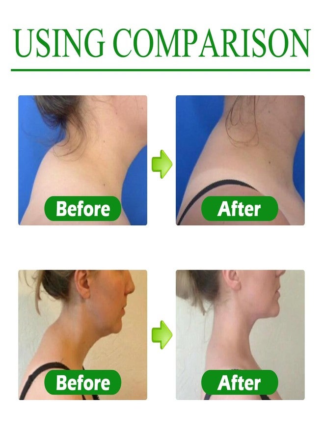 VALUEVIBES Hump Relief Patches - Wormwood Cervical Care Patch for Shoulder Strain, Lumbar Spine, and Back Discomfort (12pcs) - Image 4