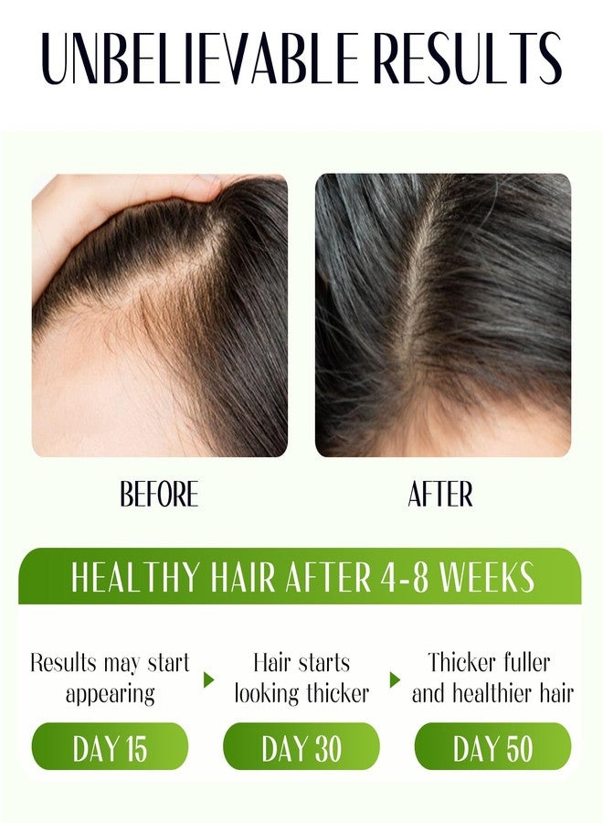 Gaayou Raw Batana Oil for Hair Growth 4-in-1 Batana Oil with Rosemary, Castor Oil and Biotin for Reduce Hair Loss, Scalp Care, Repair Damaged Hair - Image 2