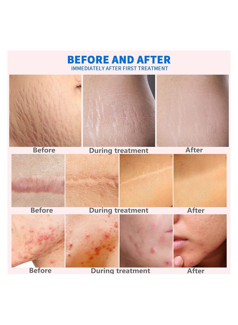 Dr pen Dr.Pen Ultima M5 Professional Microneedling Pen Wireless Electric Skin Repair Tools 12 Pins 2Needles - Image 5