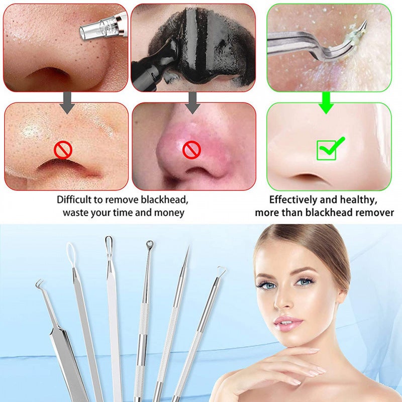 Acne Blackhead Remover Tool Kit 6-Piece Set - Image 2