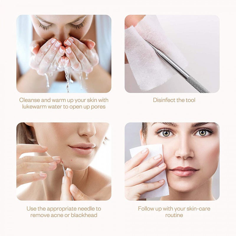Acne Blackhead Remover Tool Kit 6-Piece Set - Image 4