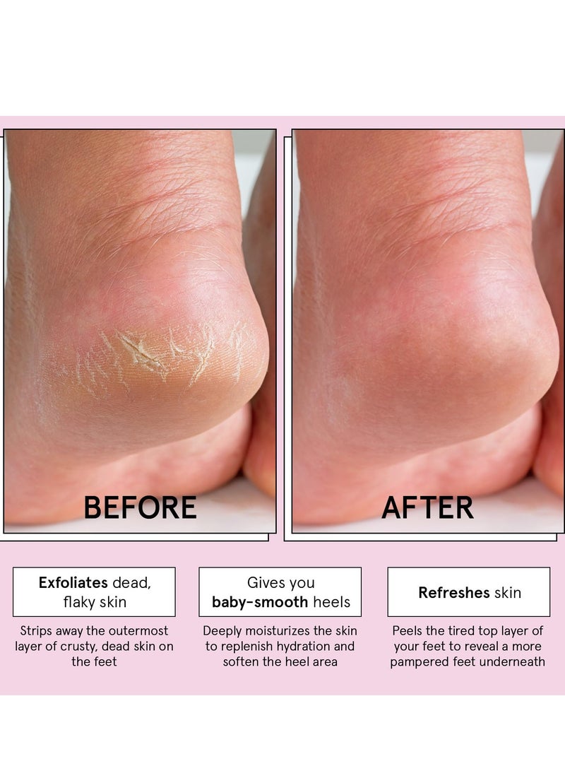 Grace & Stella grace & stella Award-Winning Foot Peel Mask (4 Pairs, Lavender) - Foot Peeling Mask with Aloe Vera - Moisturizing Foot Mask for Dry Cracked Feet - Foot Exfoliator for Baby Soft Feet  - Image 5