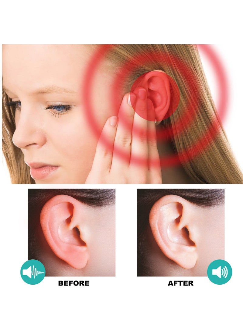 EELHOE - Tinnitus Relief Drops, Natural and Organic Tinnitus Treatment Oil, Helps Stop Tinnitus and Relieve Pain Tinnitus Relief and Remedies Natural Remedies for Tinnitus Symptoms - Image 1