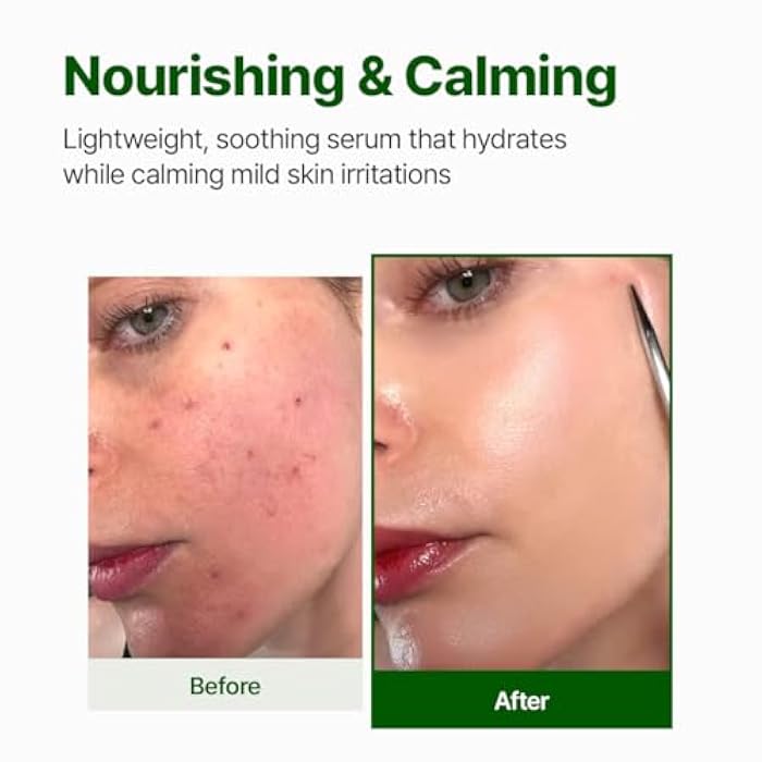 NACIFIC Cica PDRN Calming Serum 1.69 fl oz 50ml, Centella Asiatica, Soothing, Hydrating Barrier Repair for Sensitive Skin, Redness Relief, Korean Skincare, Stocking Stuffers, Christmas Gifts for Women - Image 3