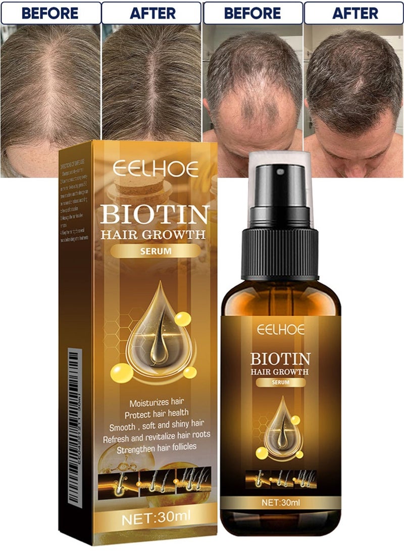 إيلهو سبري نمو الشعر بالبيوتين سعة 30 مل، مصل نمو الشعر مع صوديوم PCA – محلول مضاد لتساقط الشعر لجعل بصيلات الشعر أقوى وترطيب فروة الرأس – يعزز النمو السريع للشعر – سبري مكثف مغذي للشعر للرجال والنساء - Image 1