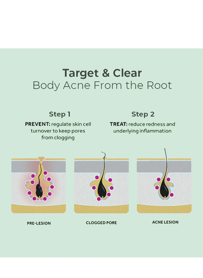 EELHOE 120ML Back Acne Soothing Spray, Clarifying Body Spray – With 2% Salicylic Acid & Tea Tree Oil, Refreshing Herbal Formula for Smooth & Balanced Skin, Fast-Absorbing & Non-Greasy Mist for Daily Skin Care - Image 3