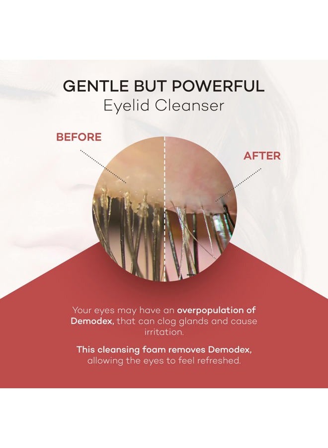 Zocular ZocuFoam Foaming Eyelid Cleanser – Gentle pH-Balanced Cleansing Foam – 25 mL - Image 4