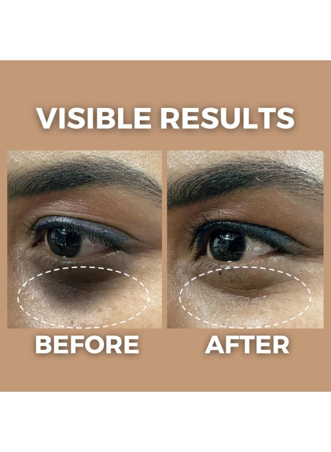 The Tribe Concepts Under Eye Brightening Oil for Dark Circles Removal, Reduces Puffiness Fine Lines, Wrinkles, Aging, Eye Pigmentation with Star Anise, Amla, Lodhra 100% Natural for Men/Women - 8 ml - Image 4