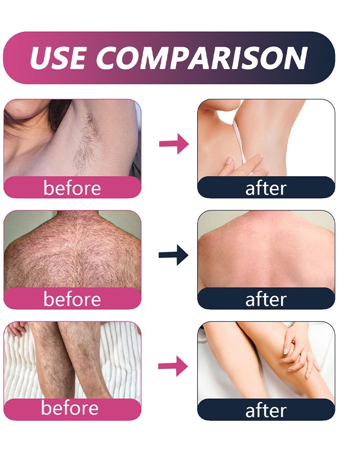 EELHOE Hair Removal Spray For Men, Painless Hair Removal Spray Armpit Gentle Hair Remover Refreshing Quick Hair Removal Spray, Natural Ingredient Hair Removal Spray For Men - Image 4