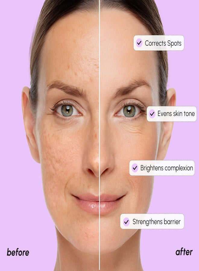 MAREE 20% Tranexamic Acid Serum Complex with Niacinamide & Vitamin C – Serum for Face & Body Dark Spot Corrector – Age Spots Hyperpigmentation Care Remover – Brightening Acido Tranexamico para Manchas - Image 4