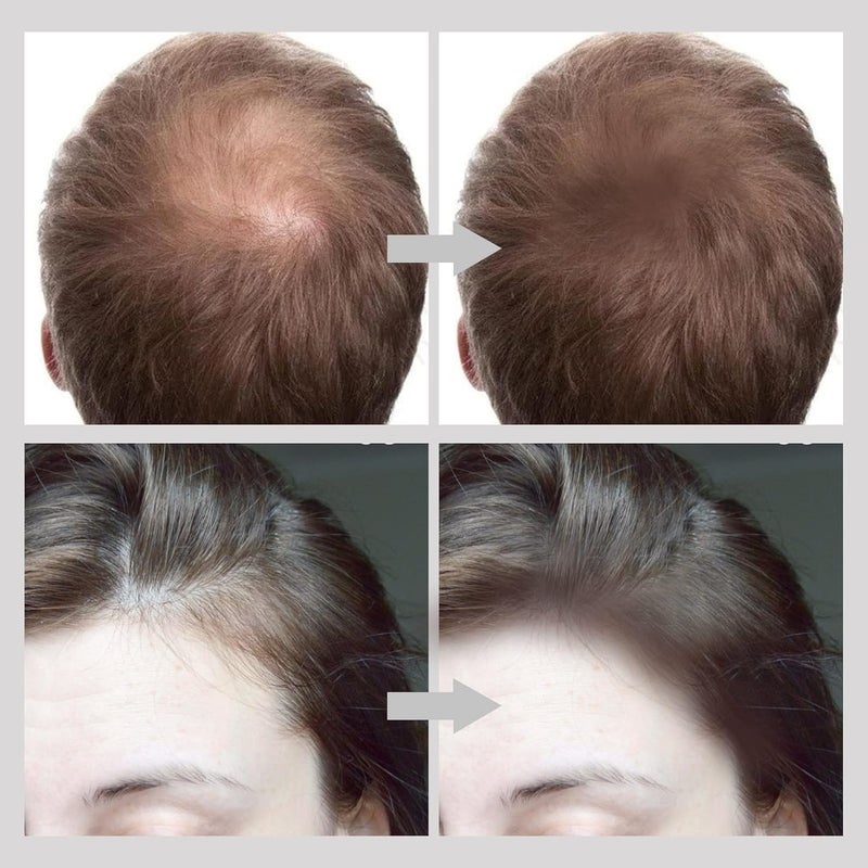 Hairline Powder StickHair Shadow Powder Root Touch Up Powder Waterproof Hair Shading Sponge Pen Hair Filler Powder For Cover Gray Hair Root Hair TouchUp - Image 5