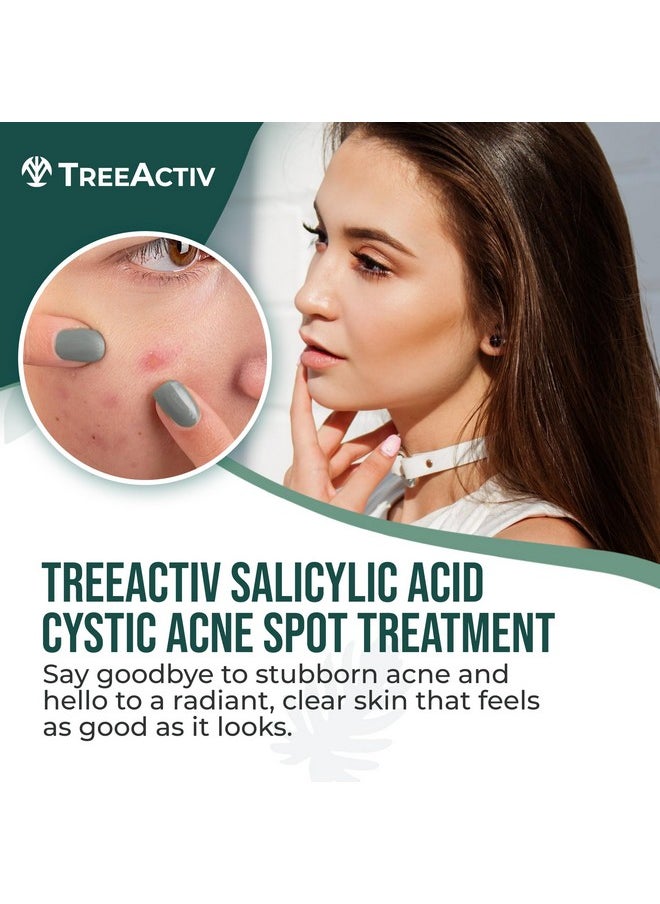 TreeActiv TreeActiv Salicylic Acid Cystic Acne Spot Treatment, 0.5 fl oz, Acne Treatment for Face, Acne Spot Cream, Hormonal Acne Treatment, Acne Spot Treatment for Face and Body, Acne Cream for Teens & Adults  - Image 2