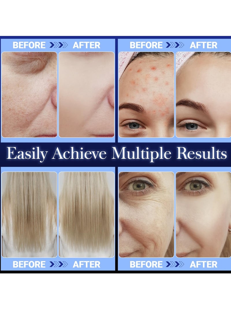 High Frequency Facial Wand for Acne and Hair Growth, Portable Handheld Blue High Frequency Machine with 4 Different Glass Tubes for Skin and Hair Care - Image 5