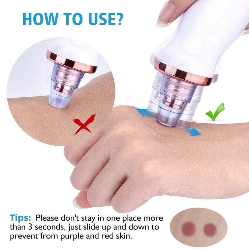 IXWQ 6in1 Multifunction Blackhead Remover Electric Derma Suction Machine USB Rechargeable Acne Pimple Pore Cleaner Vacuum Tool Facial Cleanser Whitehead Extractor Remover Device for Nose Skin Care - Image 4