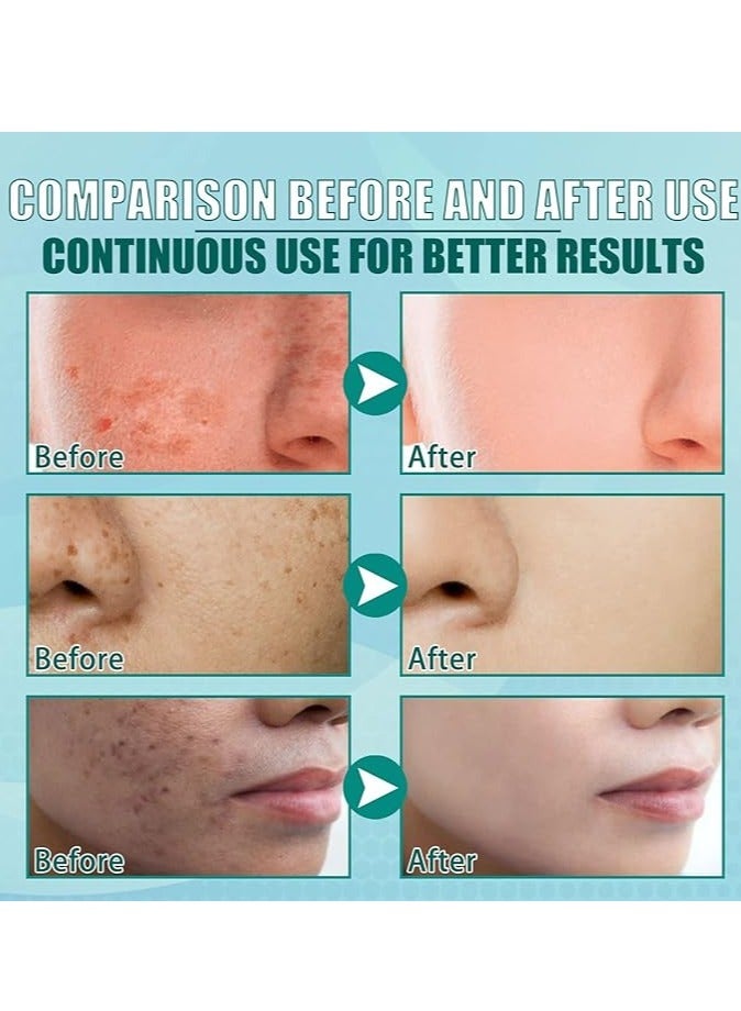 Whitening Labs Dr Hancy White Spot Cream,Whitening Cream To Remove Dark Spots and Melasma Remover, Fast-Acting Dark Spot Corrector Remover for Face and body Hyperpigmentation, Sun Spots,Age Spot Remover 20g - Image 4