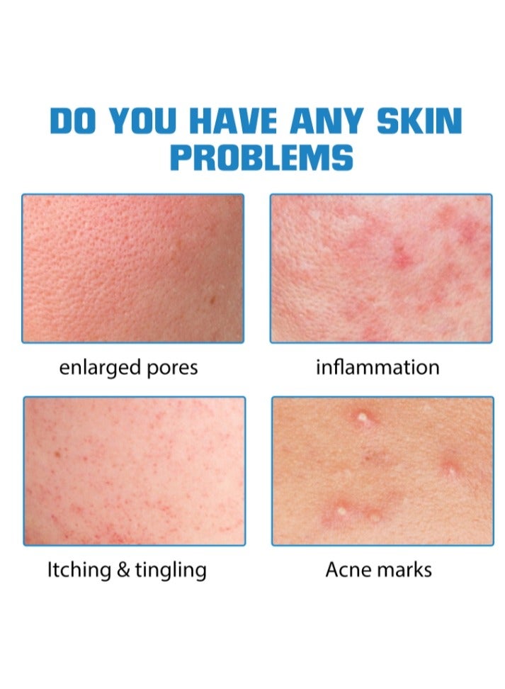 إيلهو سيروم حمض الهيالورونيك للوجه 10 مل - Image 2