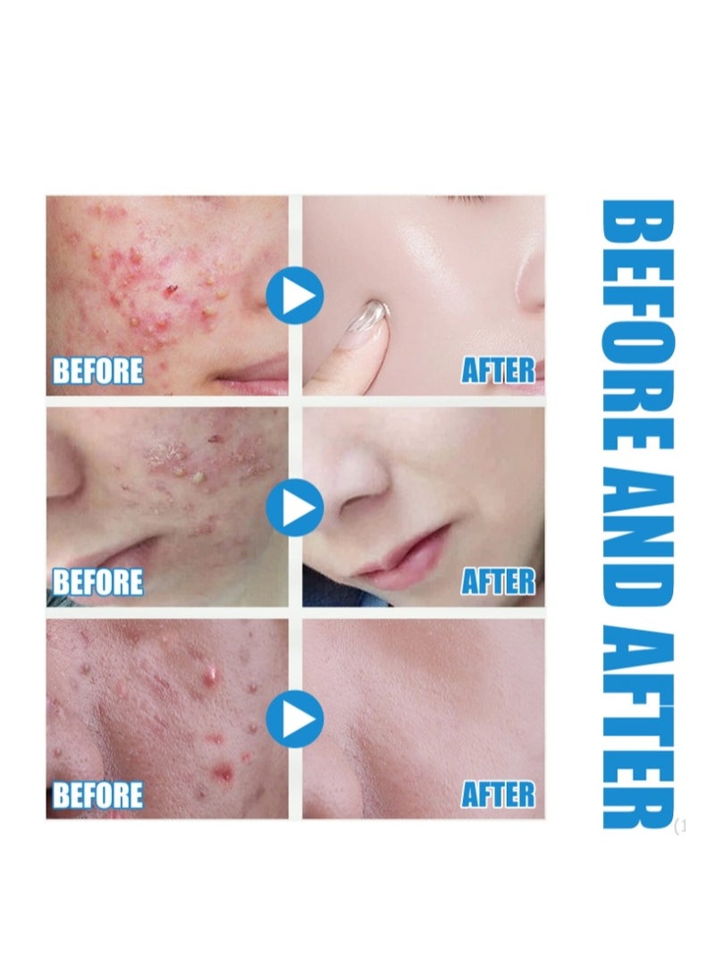 إيلهو سيروم حمض الهيالورونيك للوجه 10 مل - Image 3