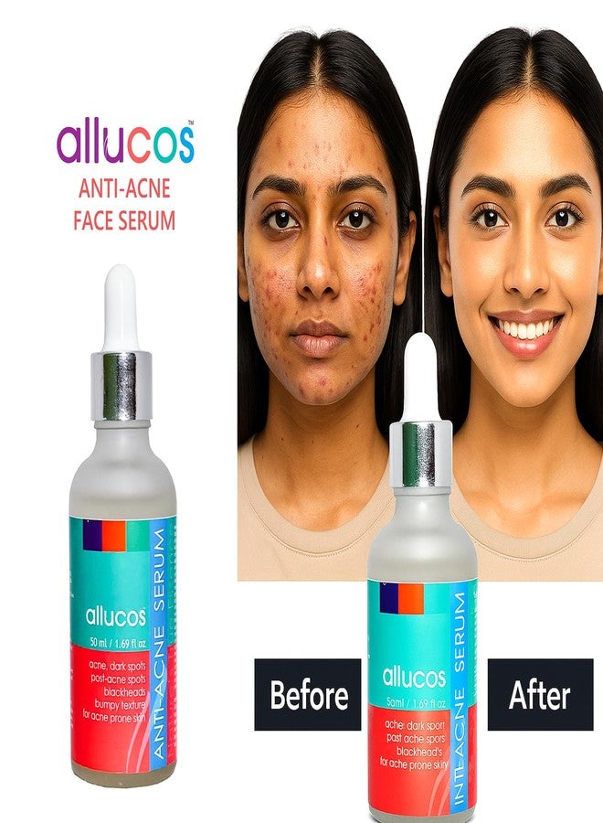 ALLUCOS Anti-Acne Serum | 100% Natural & Paraben-Free | Reduces Pimples, Blemishes & Acne Scars | Controls Oil & Soothes Skin | Suitable for All Skin Types - For Men & Women - 30ml (Pack of 1) - Image 3