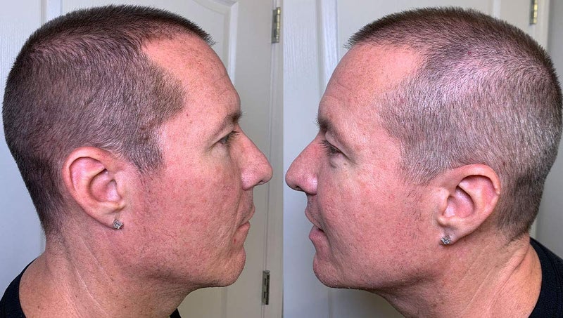 Simply Extensions Thicken It 100% Scalp Coverage Hair Powder - DARK BROWN - Talc-Free .32 oz. Water Resistant Hair Loss Concealer. Naturally Thicker Than Hair Fibers & Spray Concealers - Image 1