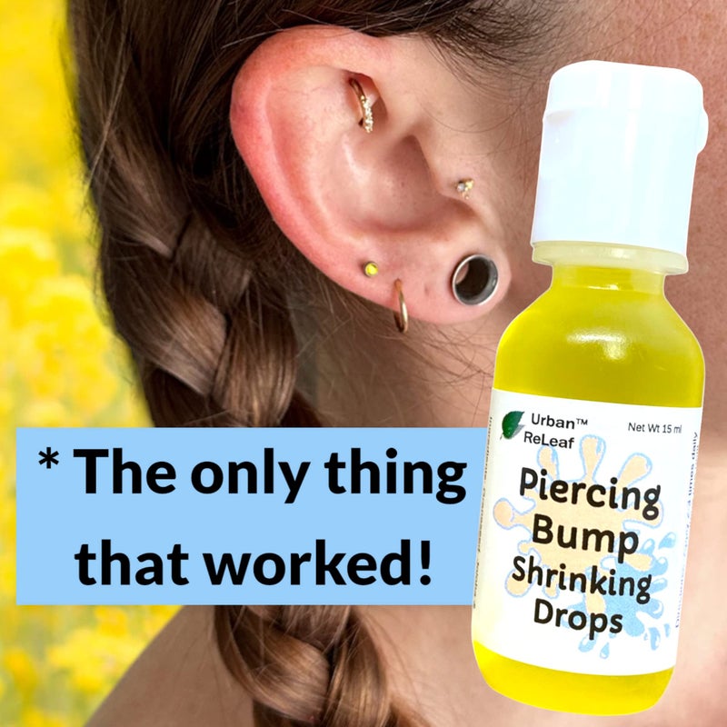 Urban ReLeaf Piercing Bump Shrinking Drops! Keloid Bumps Gentle Effective Aftercare Solution. Natural Essential Oils. Fast Removal Help for Scars Nodules Cartilage Nose Ear Spots. Clean Soothe - Image 5