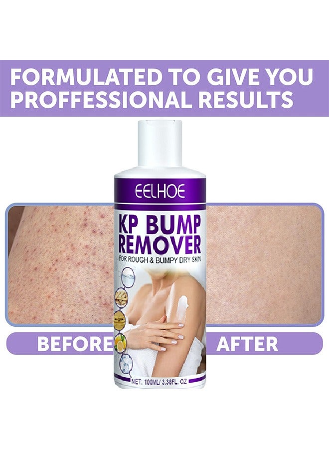 EELHOE KP Bump Remover - 100ml Pilaris Keratinizing Moisturizer with Lactic Acid - Exfoliating and Moisturizing Cream for Problematic Keratinization, Dry, Rough and Bumpy Skin 100ml - Image 4