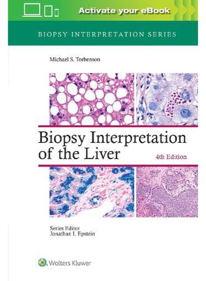 Biopsy Interpretation of the Liver  Ed   4