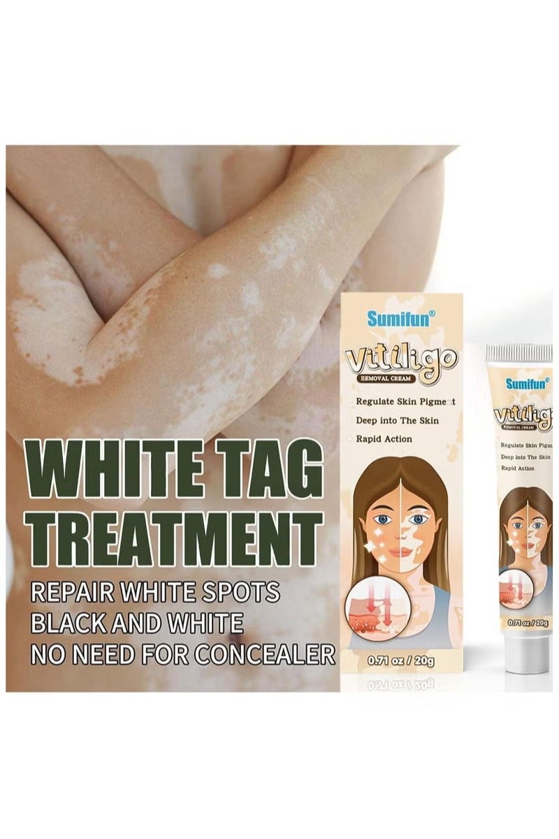 سوميفون كريم العناية بالبشرة فيتيليغو ، يقلل من البقع البيضاء ، وتحسين صبغة الجلد - Image 4