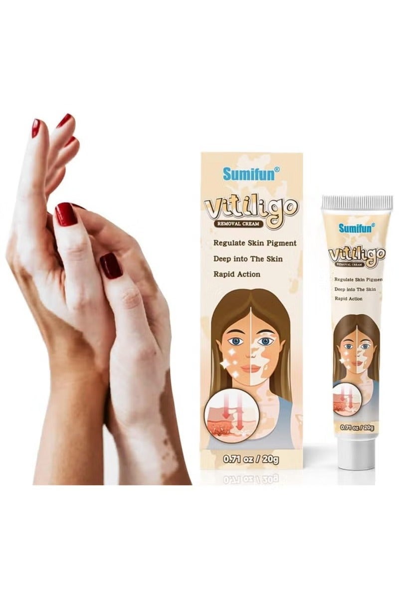 سوميفون كريم العناية بالبشرة فيتيليغو ، يقلل من البقع البيضاء ، وتحسين صبغة الجلد - Image 1
