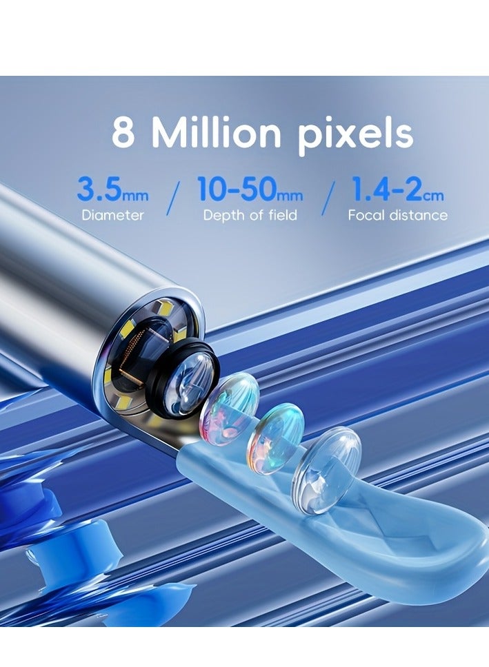 Camera-equipped, Rechargeable, Intelligent Ear Wax Remover With Ear Scoop, 4pcs Ear Spoon Head, Ear Wax Removal Kit For Adults - Image 2