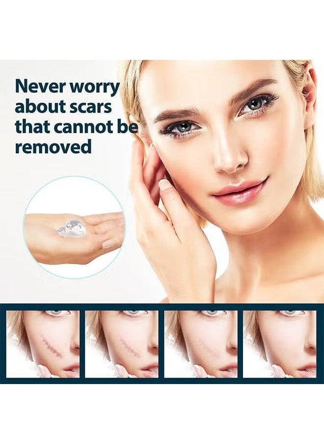 LANEMAY Scar Cream, Medical Grade Silicone Scar Cream Advanced Scar Removal Gel For Surgical Scars Stretch Marks Acne Injury Burns Keloids Hypertrophic Old And New Scars 20G  - Image 5