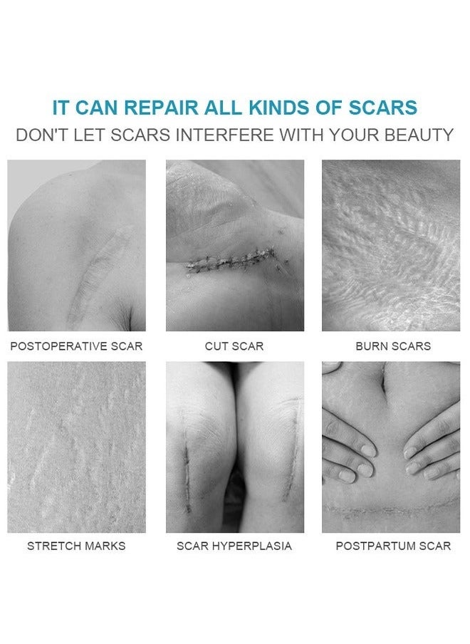 LANEMAY Scar Cream, Medical Grade Silicone Scar Cream Advanced Scar Removal Gel For Surgical Scars Stretch Marks Acne Injury Burns Keloids Hypertrophic Old And New Scars 20G  - Image 3