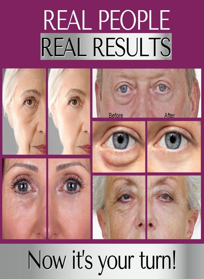 DERMAWORKS IMMACULIFT EYE BAGS REMOVER Men & Women - Eye Cream for Dark Circles and Puffy Eyes Bags Under Eyes - Instant Face Lift - Instant Wrinkle Remover for Face Tightening Cream -Temporary Skin Tightening - Image 4