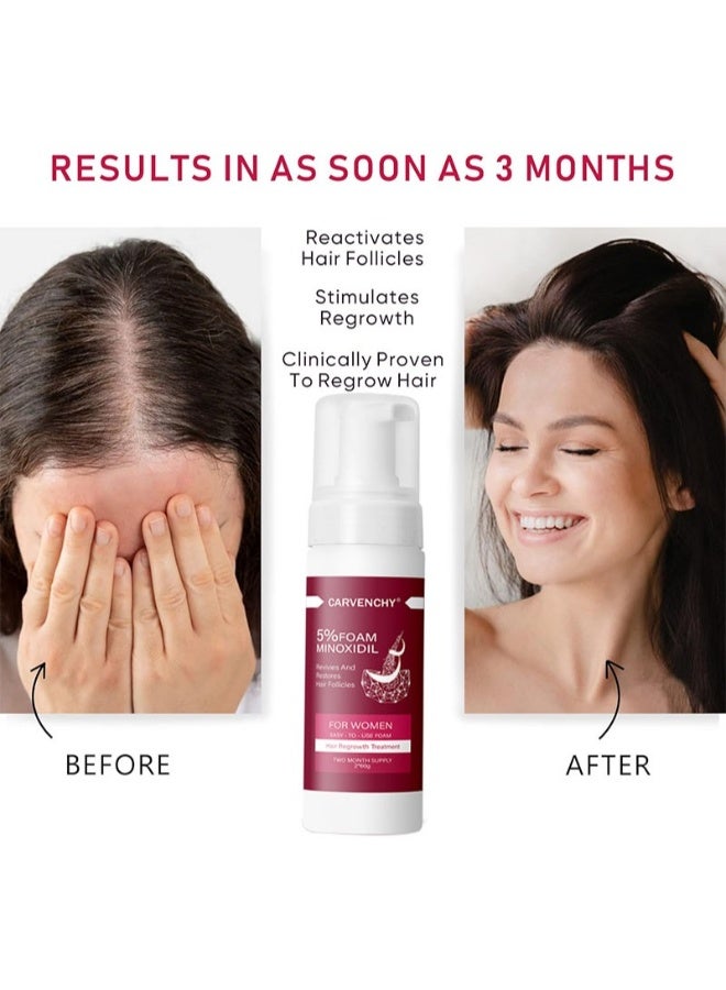 CARVENCHY 5% Minoxidil Foam for Hair Thinning and Hair Loss, Revivies And Restores Hair Follicles,Hair Growth Treatment for Women's Thicker and Fuller Hair,Easy-to-use Foam 2 Pack of 60g - Image 4