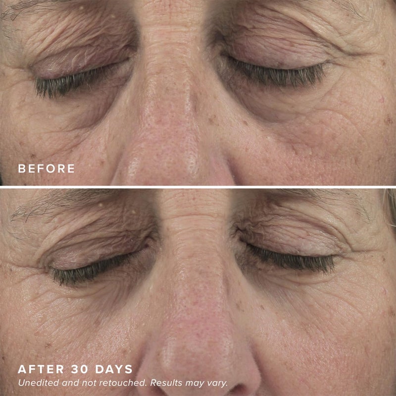 DRMTLGY Brightening Eye Masks (30 Pairs) - Caffeine Eye Masks for Dark Circles and Puffiness with Hyaluronic Acid, Eye Patches for Puffy Eyes - Image 5