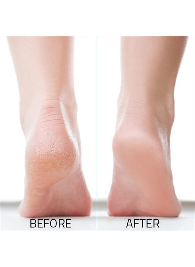 JAIRESTONE Pumice Stone - Callus Remover and Foot Stone Scrubber - Exfoliating Foot Stone Pumice Rock for Hard, Dry and Dead Skin on Heels, Body, Feet (Pack of 2) (White)  - Image 3
