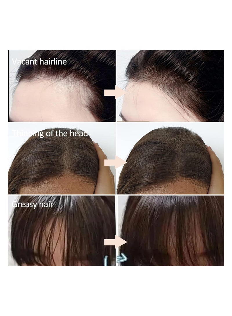 Hairline Powder, Instantly Conceals Hair Loss, Hair Powder for Thin Hair, Root Touch Up Powder Hair Shadow Cover Hair Loss Instantly, Hairline Powder for Women Men, Root Touch Up Hair Powder (Brown) - Image 4