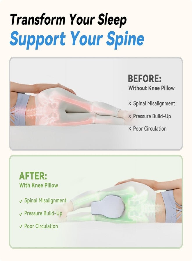 UJPFEO Knee Pillow - Image 2