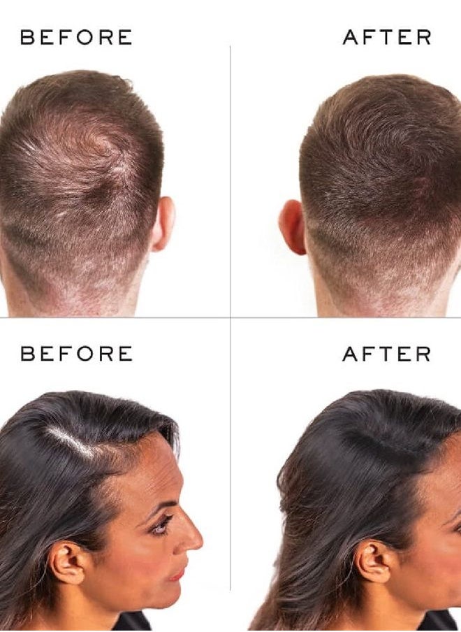 Nanogen Hair Thickening Keratin Fibres Black  - Image 3
