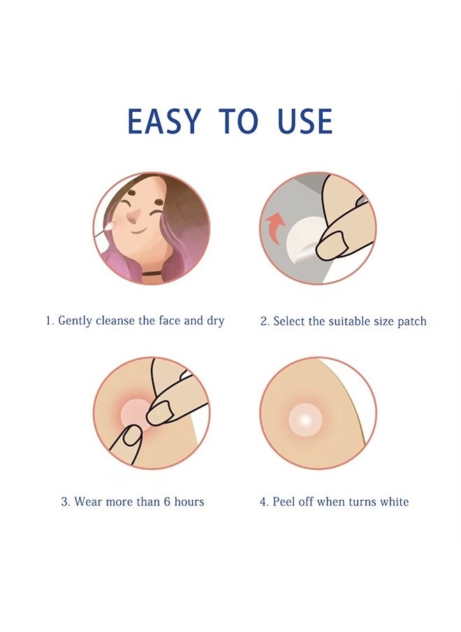Acne Patches Absorbing Pimple Patches Invisible Spot Stickers Translucent Hydrocolloid Spot Patches, Facial Treatment, Fast Healing, Two Sizes(108 Patches)