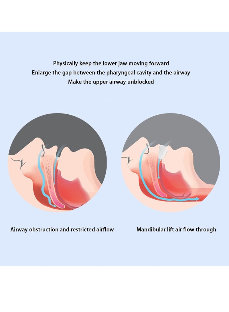 general Anti-snoring mouthpiece solution, sleep relaxation and comfort system, natural sleep aid device developed by dentists, mouthpieces for men and women - Image 4