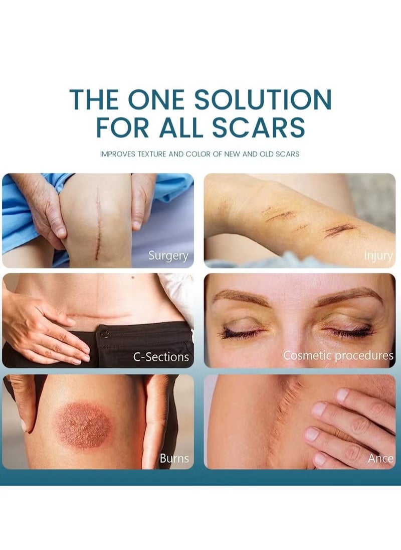 Sumifun - Lighten scar gel to fade scar scald - Image 1