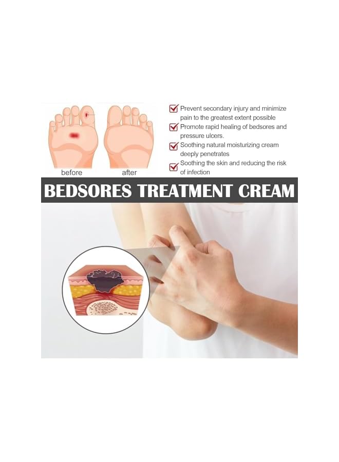 إيلهو كريم لعلاج ومنع قرح الضغط، مرهم عشبي لقرح الفراش، تخفيف للقرح من المرحلة 1 إلى 4، 20 جرام - Image 5